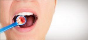 Person examining their teeth with a dental mirror 