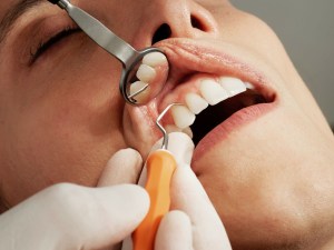 Face shot of dental patient's teeth being worked on