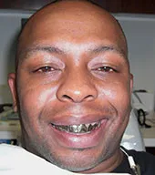 Custom-grill